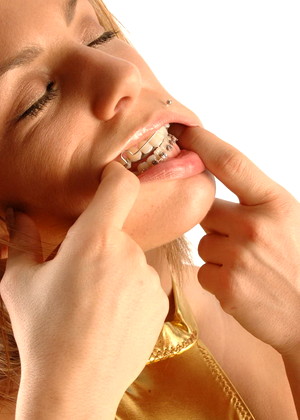 Beautyandbraces Model jpg 10