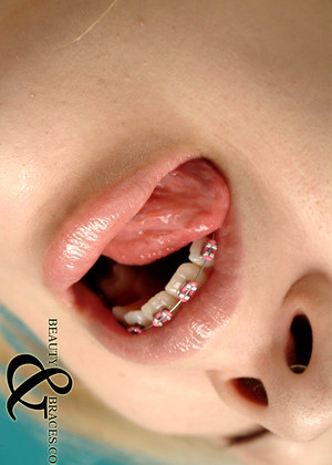 Beautyandbraces Model jpg 11