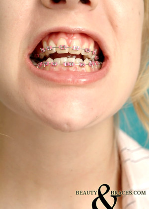 Beautyandbraces Model jpg 15