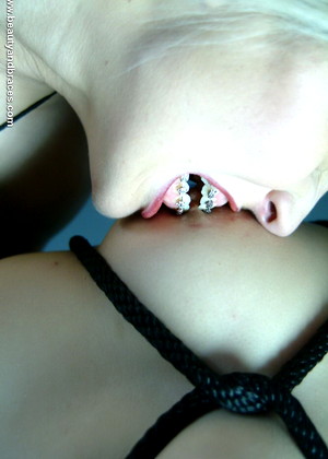 Beautyandbraces Model jpg 11