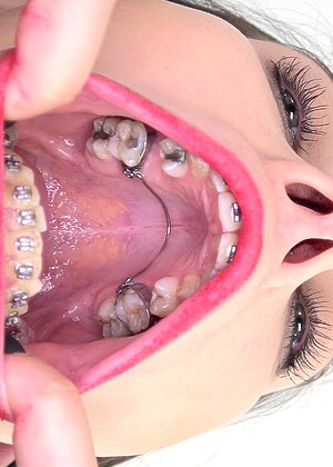 Insidemymouth Model