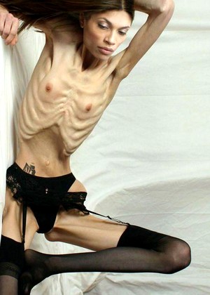 Absoluteskinny Model pics