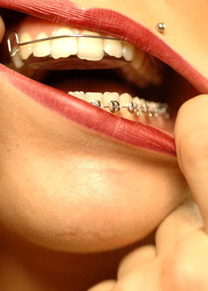 Beautyandbraces Model jpg 9