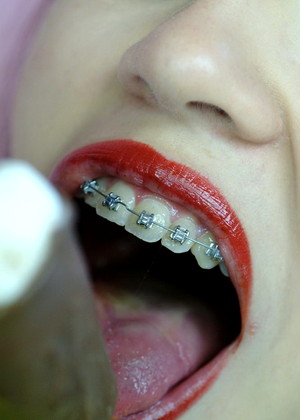 Beautyandbraces Model jpg 12