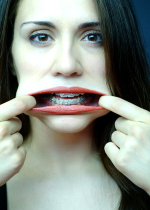 Beautyandbraces Model pics