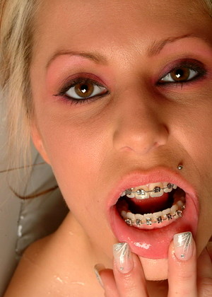 Beautyandbraces Model jpg 7