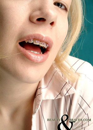 Beautyandbraces Model jpg 10