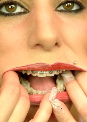 Beautyandbraces Model jpg 6