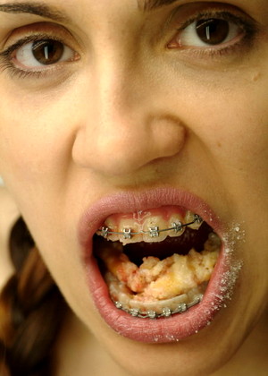 Beautyandbraces Model jpg 11