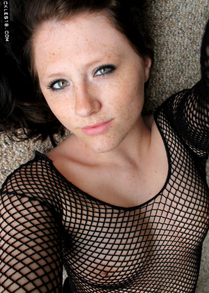 freckles18 Freckles pics