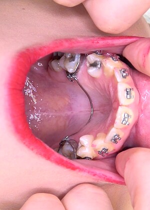 Inside My Mouth