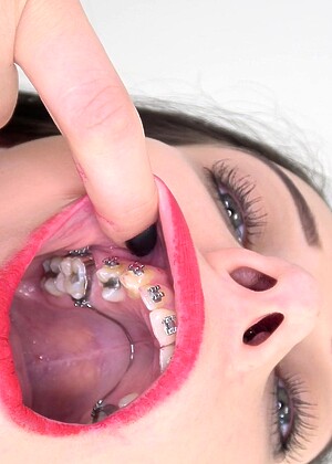 Insidemymouth Model pics