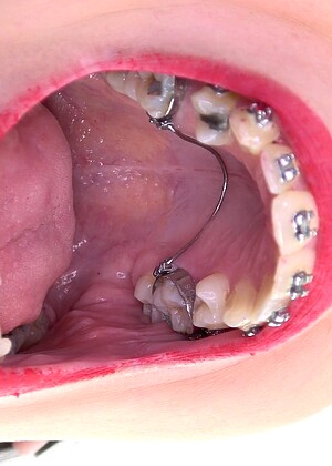 Inside My Mouth