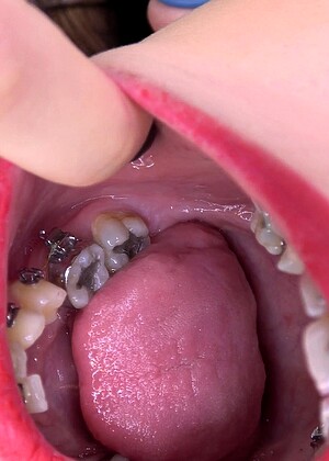 Inside My Mouth